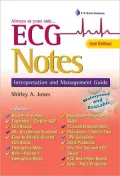 ECG Notes: Interpretation and Management Guide