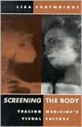 Screening the Body: Tracing Medicine's Visual Culture