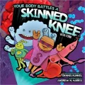 Skinned Knee