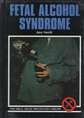 Fetal Alcohol Syndrome