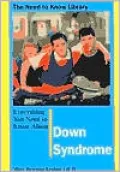 Everything You Need to Know about Down Syndrome