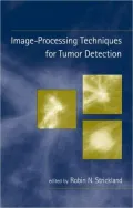 Image-Processing Techniques for Tumor Detection