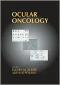 Ocular Oncology