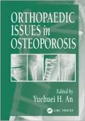 Orthopaedic Issues in Osteoporosis