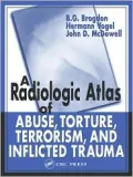 A Radiologic Atlas of Abuse, Torture, Terrorism and Inflicted Trauma