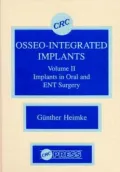Osseo-Integrated Implants