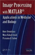 Image Processing with MATLAB Applications in Medicine and Biology