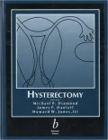 Hysterectomy