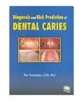 Diagnosis and Risk Prediction of Dental Caries, Vol. 2