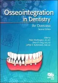 Osseointegration in Dentistry: An Overview