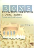 Bone Biology, Harvesting, Grafting for Dental Implants