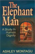 Elephant Man: A Study in Human Dignity
