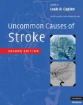 Uncommon Causes of Stroke