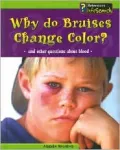 Why Do Bruises Change Color?: And Other Questions about Blood