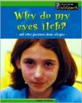Why Do My Eyes Itch?: And Other Questions about Allergies