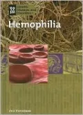 Hemophilia