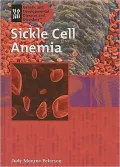 Sickle Cell Anemia