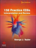 150 Practice ECG's: Interpretation and Review
