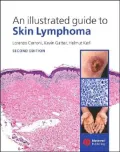 An Illustrated Guide to Skin Lymphoma