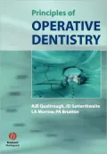 Principles of Operative Dentistry