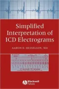 Simplified Interpretation Elec