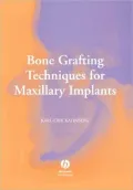 Bone Graft Maxil Implants
