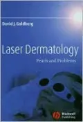 Laser Dermatology: Pearls and Problems