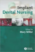 Implant Dental Nursing