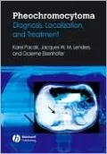 Pheochromocytoma: Diagnosis, Localization, and Treatment