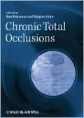 Chronic Total Occlusions: A Guide to Recanalization