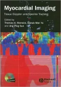 Myocardial Imaging: Tissue Doppler and Speckle Tracking