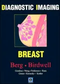 Diagnostic Imaging: Breast