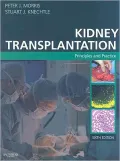 Kidney Transplantation: Principles and Practice