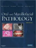 Oral and Maxillofacial Pathology