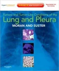 Tumors and Tumor-like Conditions of the Lung and Pleura: Expert Consult: Online and Print