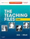 The Teaching Files: Chest: Expert Consult - Online and Print