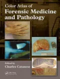 Book cover of Forensic Medicine and Pathology