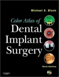 Color Atlas of Dental Implant Surgery