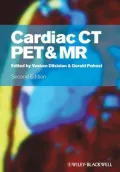 Cardiac CT, PET and MR