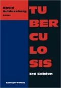 Tuberculosis