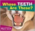 Whose Teeth Are These?