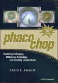PHACO CHOP: Mastering Techniques, OptimizingTechnology, and Avoiding Complications,1st