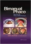 Bimanual Phaco: Mastering the Phakonit/MICS Technique