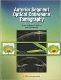 Anterior Segment Optical Coherence Tomography