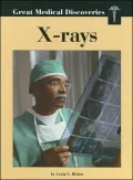 X-Rays