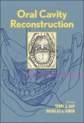 Soft Tiss Recon Oral Cavity