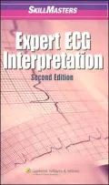 SkillMasters: Expert ECG Interpretation