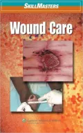 SkillMasters: Wound Care