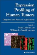 Expression Profiling of Human Tumors : Diagnostic and Research Applications