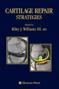 Cartilage Repair Strategies